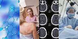Consulta p�blica para o Rol da ANS 2014/2015 sobre Terapia Imunobiol�gica Subcut�nea no Tratamento da Asma Grave